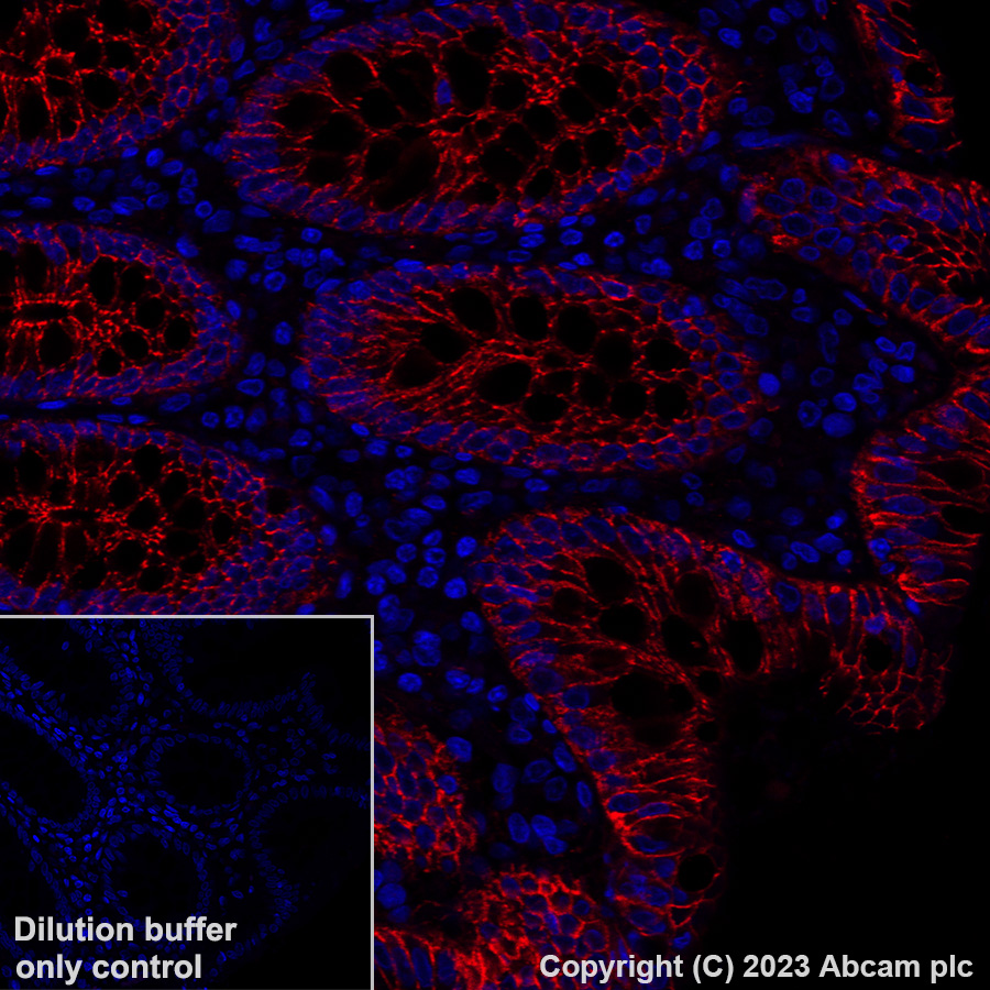 Immunohistochemistry (Formalin/PFA-fixed paraffin-embedded sections) - Alexa Fluor® 647 Anti-beta Catenin non-phospho(active) S45 antibody [EPR26155-110-1] (AB316940), expandable thumbnail