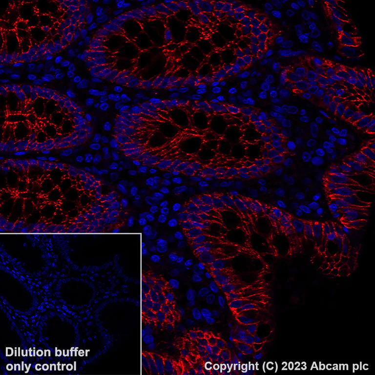 Immunohistochemistry (Formalin/PFA-fixed paraffin-embedded sections) - Alexa Fluor® 647 Anti-beta Catenin non-phospho(active) S45 antibody [EPR26155-110-1] (AB316940)