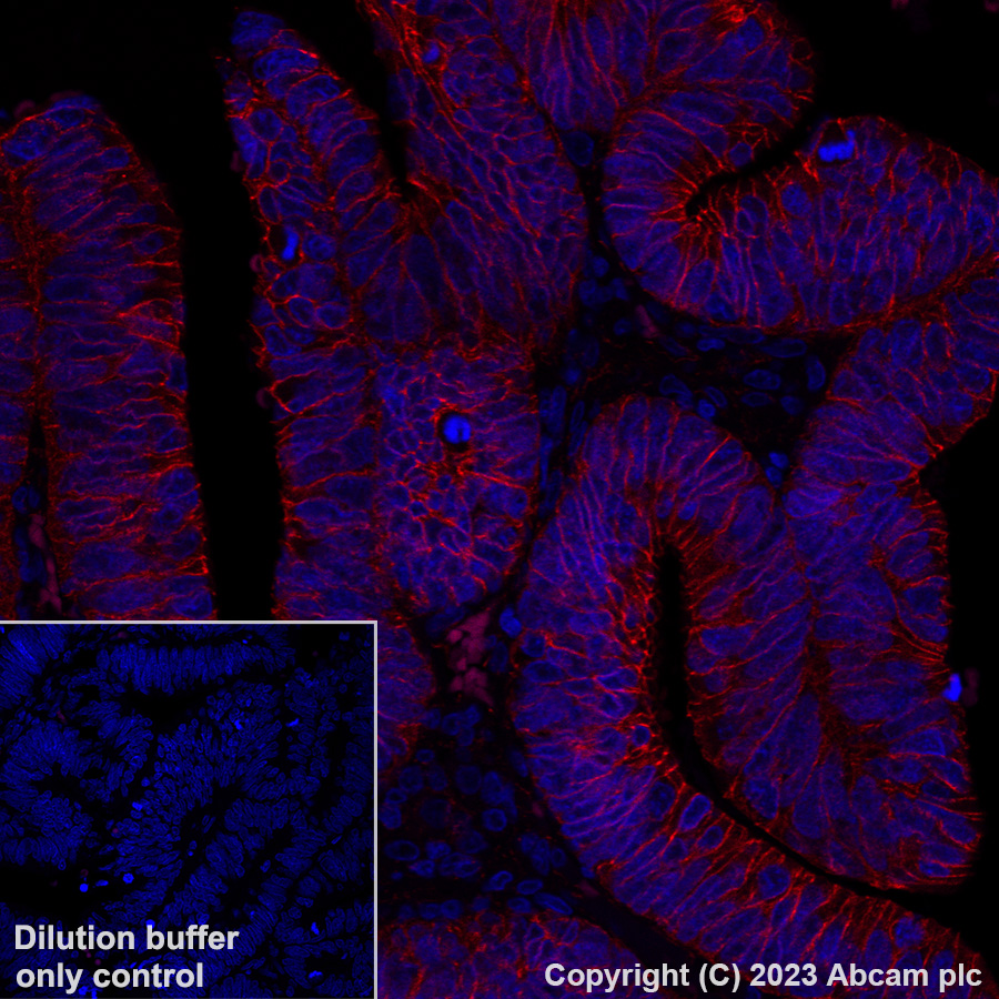 Immunohistochemistry (Formalin/PFA-fixed paraffin-embedded sections) - Alexa Fluor® 647 Anti-beta Catenin non-phospho(active) S45 antibody [EPR26155-110-1] (AB316940), expandable thumbnail
