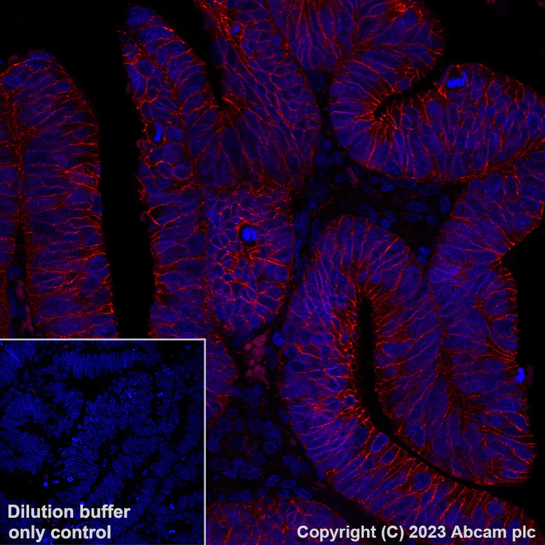 Immunohistochemistry (Formalin/PFA-fixed paraffin-embedded sections) - Alexa Fluor® 647 Anti-beta Catenin non-phospho(active) S45 antibody [EPR26155-110-1] (AB316940)