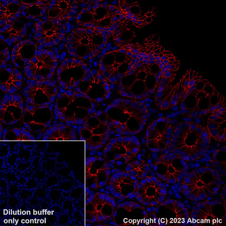 Immunohistochemistry (Formalin/PFA-fixed paraffin-embedded sections) - Alexa Fluor® 647 Anti-beta Catenin non-phospho(active) S45 antibody [EPR26155-110-1] (AB316940)