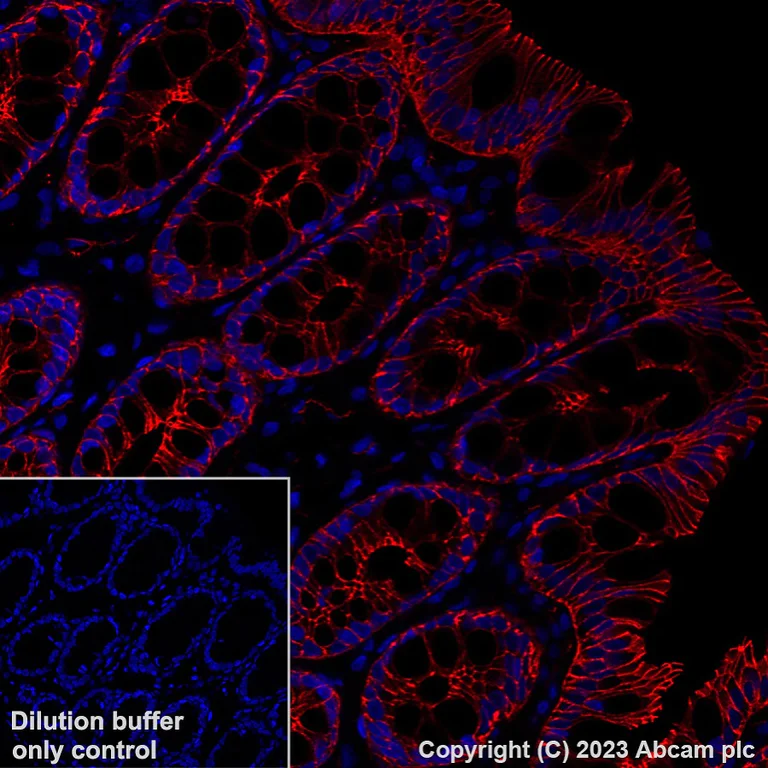 Immunohistochemistry (Formalin/PFA-fixed paraffin-embedded sections) - Alexa Fluor® 647 Anti-beta Catenin non-phospho(active) S45 antibody [EPR26155-110-1] (AB316940)