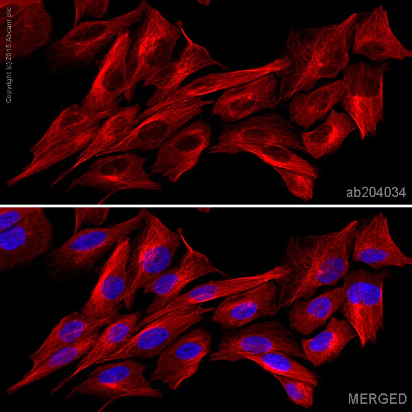 Immunocytochemistry/ Immunofluorescence - Alexa Fluor® 647 Anti-beta IV Tubulin antibody [EPR16775] (AB204034)