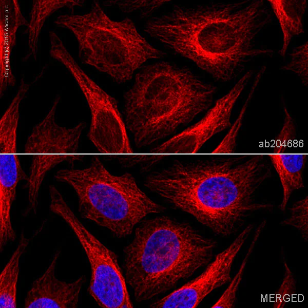 Immunocytochemistry/ Immunofluorescence - Alexa Fluor® 647 Anti-beta Tubulin antibody [EPR16774] - Microtubule Marker (AB204686)