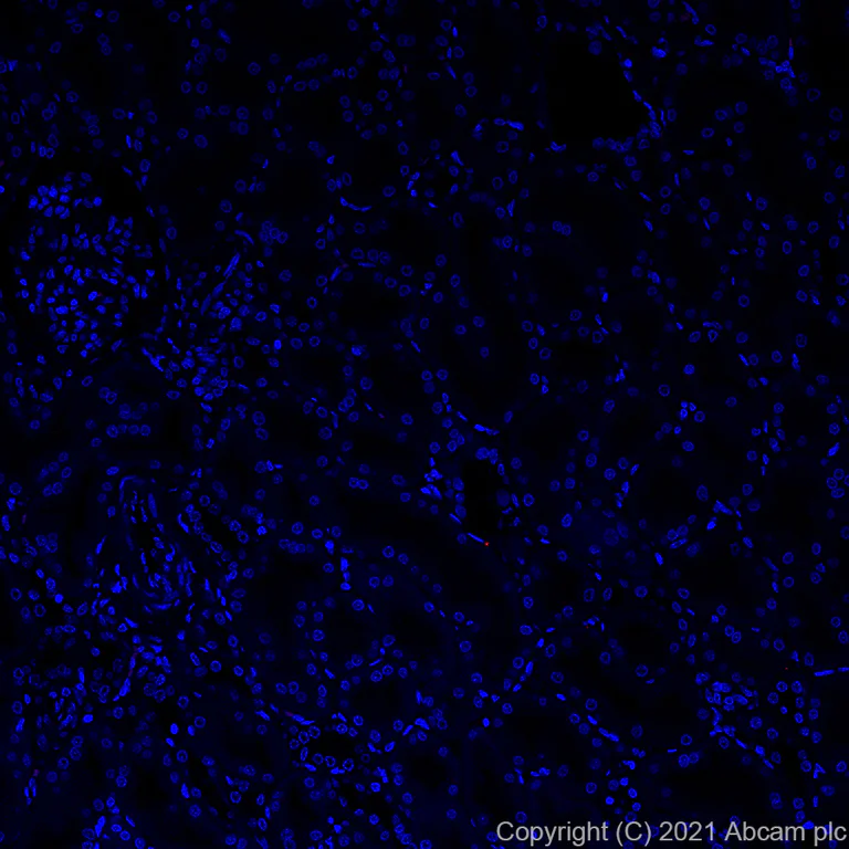 Immunohistochemistry (Formalin/PFA-fixed paraffin-embedded sections) - Alexa Fluor® 647 Anti-BLBP antibody [EPR24033-13] (AB281734)