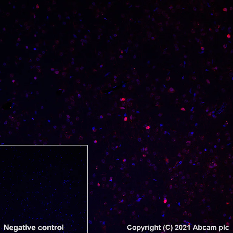Immunohistochemistry (Formalin/PFA-fixed paraffin-embedded sections) - Alexa Fluor® 647 Anti-BLBP antibody [EPR24033-13] (AB281734)
