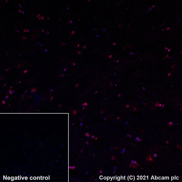 Immunohistochemistry (Formalin/PFA-fixed paraffin-embedded sections) - Alexa Fluor® 647 Anti-BLBP antibody [EPR24033-13] (AB281734)