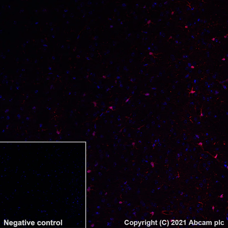 Immunohistochemistry (Formalin/PFA-fixed paraffin-embedded sections) - Alexa Fluor® 647 Anti-BLBP antibody [EPR24033-13] (AB281734)