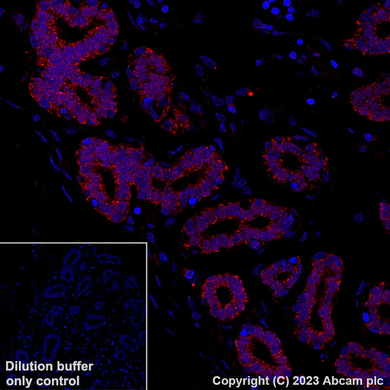 Immunohistochemistry (Formalin/PFA-fixed paraffin-embedded sections) - Alexa Fluor® 647 Anti-BRAF antibody [EP152Y] (AB309081)