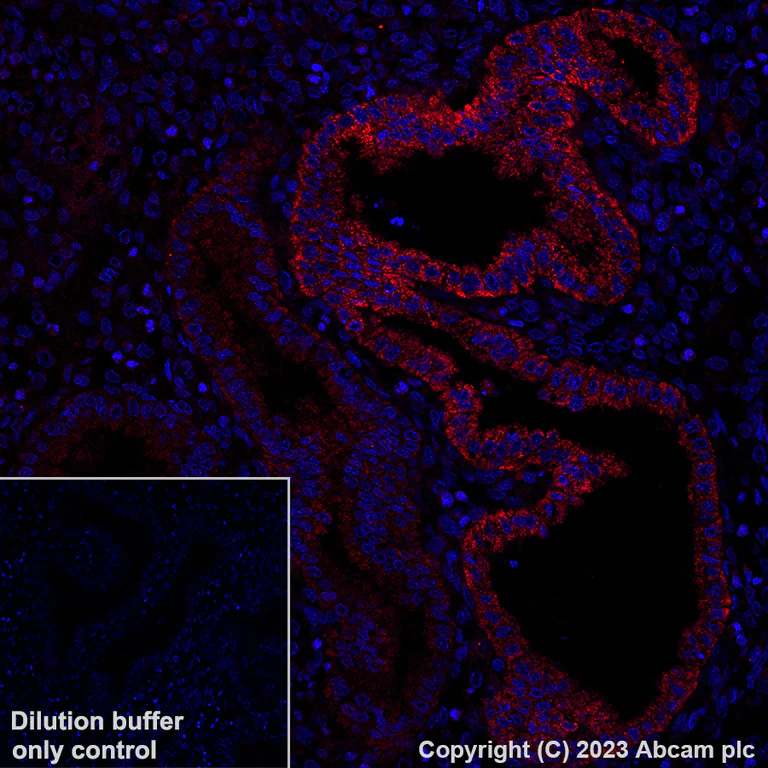 Immunohistochemistry (Formalin/PFA-fixed paraffin-embedded sections) - Alexa Fluor® 647 Anti-BRAF antibody [EP152Y] (AB309081)