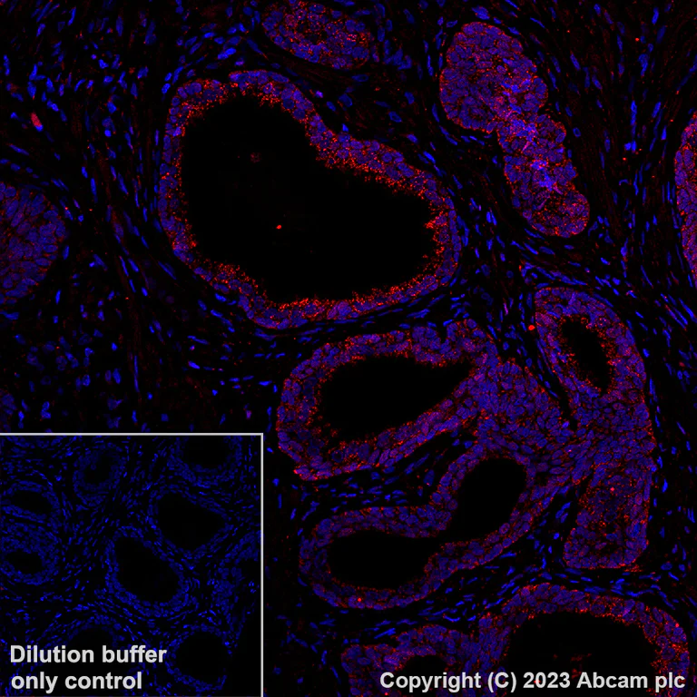 Immunohistochemistry (Formalin/PFA-fixed paraffin-embedded sections) - Alexa Fluor® 647 Anti-BRAF antibody [EP152Y] (AB309081)