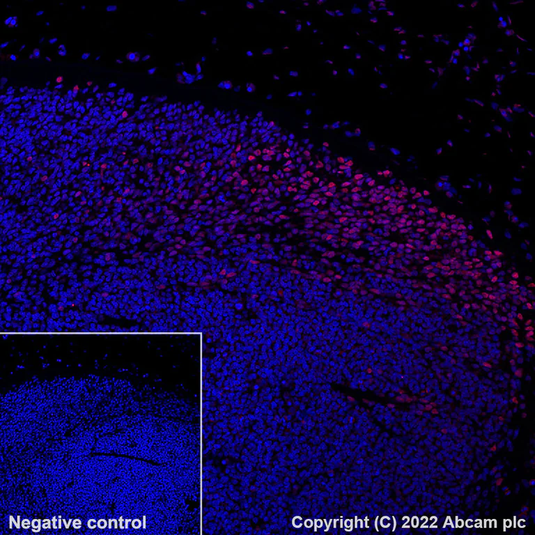 Immunohistochemistry (Formalin/PFA-fixed paraffin-embedded sections) - Alexa Fluor® 647 Anti-BRN3A antibody [EPR23257-285] (AB300744)