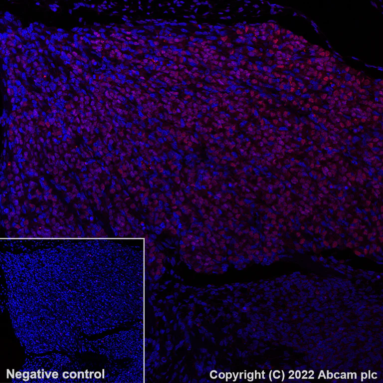 Immunohistochemistry (Formalin/PFA-fixed paraffin-embedded sections) - Alexa Fluor® 647 Anti-BRN3A antibody [EPR23257-285] (AB300744)