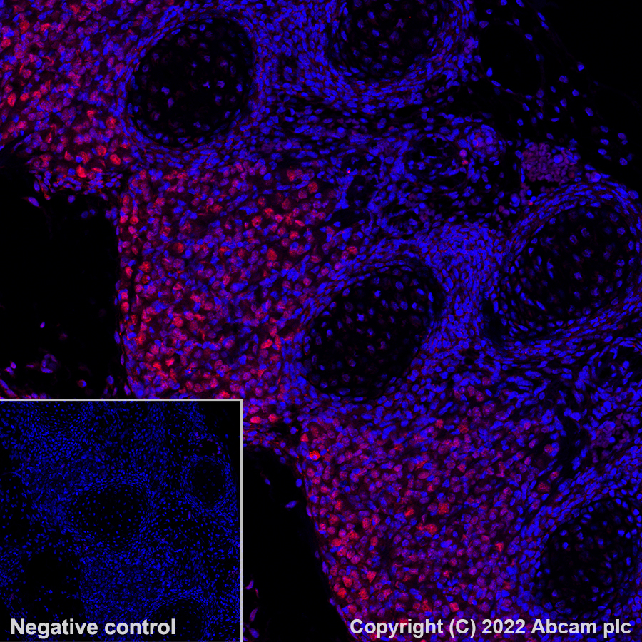 Immunohistochemistry (Formalin/PFA-fixed paraffin-embedded sections) - Alexa Fluor® 647 Anti-BRN3A antibody [EPR23257-285] (AB300744)