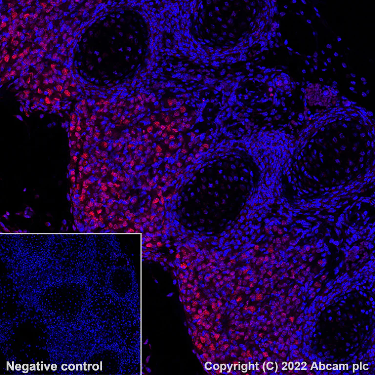 Immunohistochemistry (Formalin/PFA-fixed paraffin-embedded sections) - Alexa Fluor® 647 Anti-BRN3A antibody [EPR23257-285] (AB300744)
