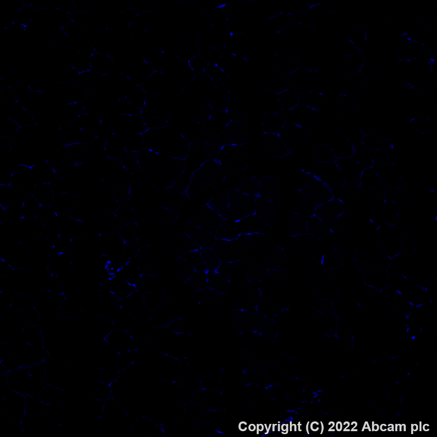 Immunohistochemistry (Formalin/PFA-fixed paraffin-embedded sections) - Alexa Fluor® 647 Anti-BST2/Tetherin antibody [EPR23597-202] (AB305206), expandable thumbnail