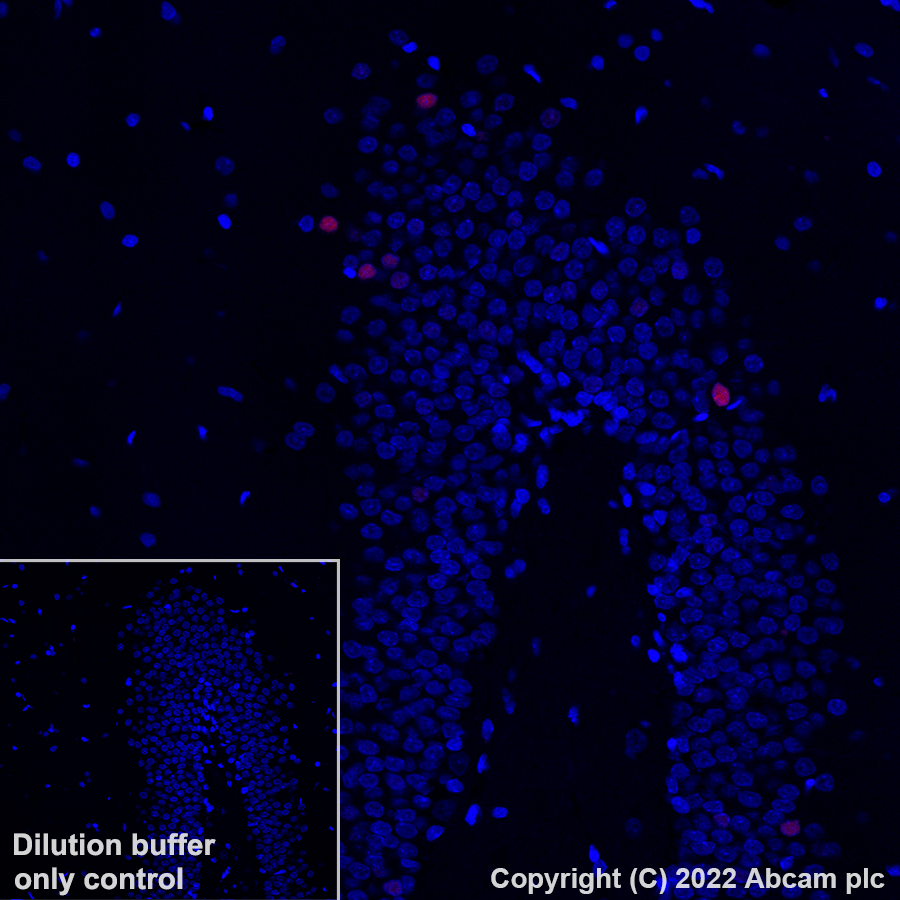 Immunohistochemistry (Formalin/PFA-fixed paraffin-embedded sections) - Alexa Fluor® 647 Anti-c-Fos antibody [EPR24046-20] (AB307378), expandable thumbnail