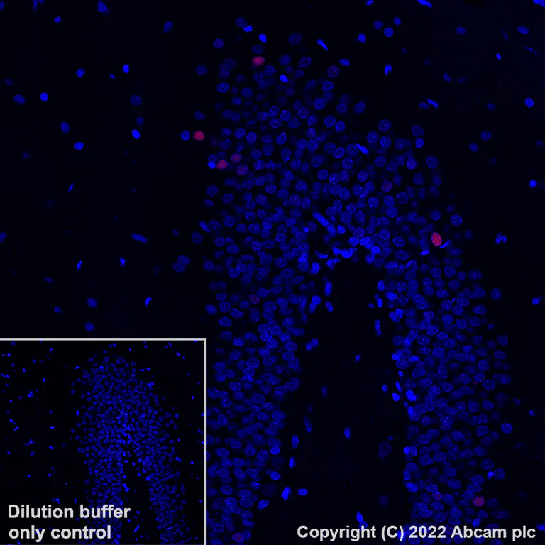 Immunohistochemistry (Formalin/PFA-fixed paraffin-embedded sections) - Alexa Fluor® 647 Anti-c-Fos antibody [EPR24046-20] (AB307378)