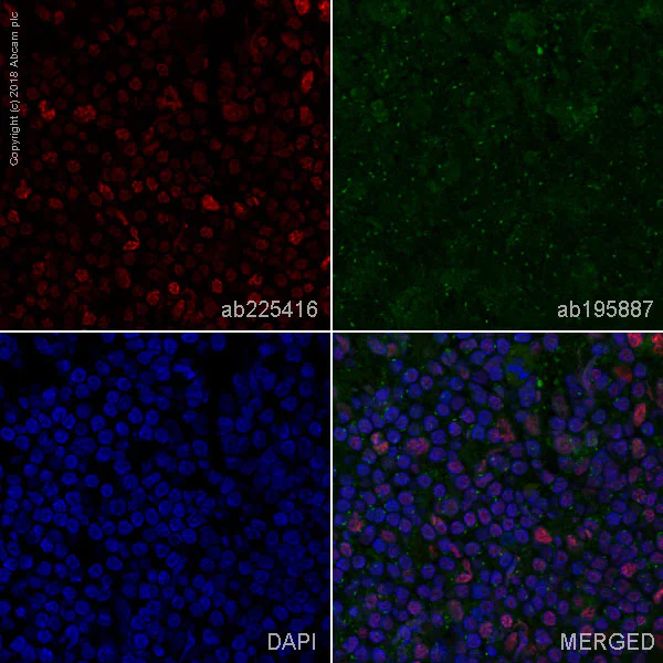 Immunohistochemistry (Frozen sections) - Alexa Fluor® 647 Anti-c-Maf antibody [EPR16484] (AB225416)