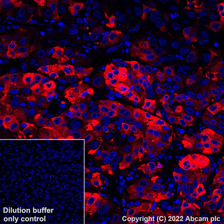 Immunohistochemistry - Alexa Fluor® 647 Anti-C Reactive Protein antibody [Y284] (AB307519)
