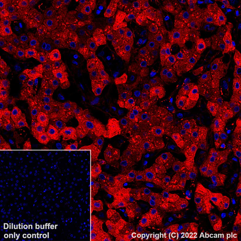 Immunohistochemistry - Alexa Fluor® 647 Anti-C Reactive Protein antibody [Y284] (AB307519)