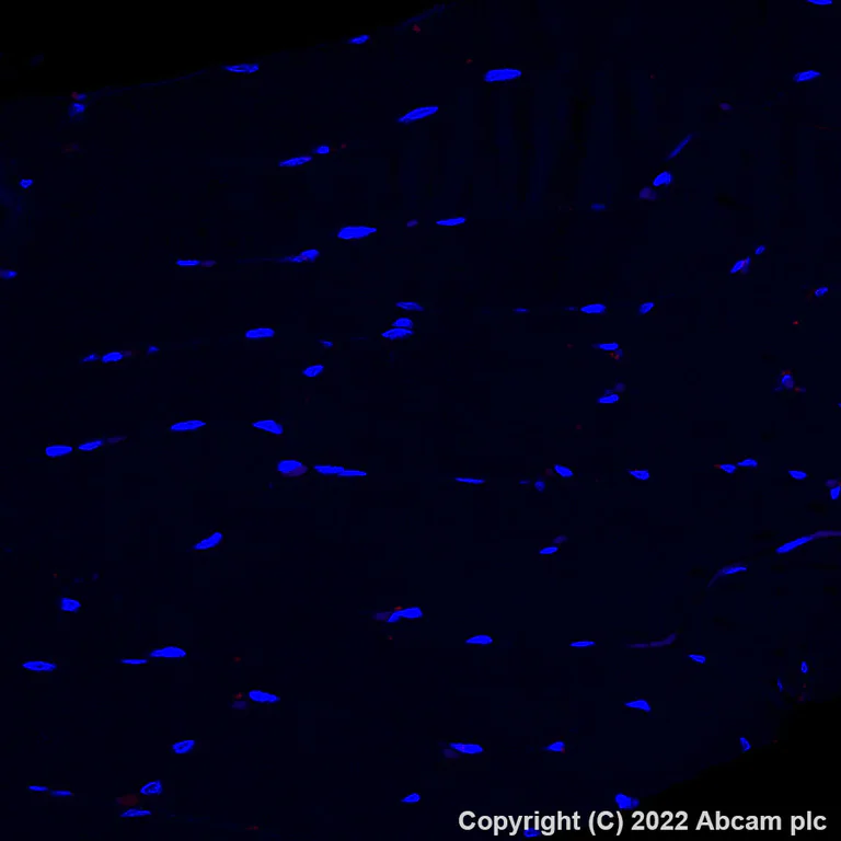 Immunohistochemistry - Alexa Fluor® 647 Anti-C Reactive Protein antibody [Y284] (AB307519)
