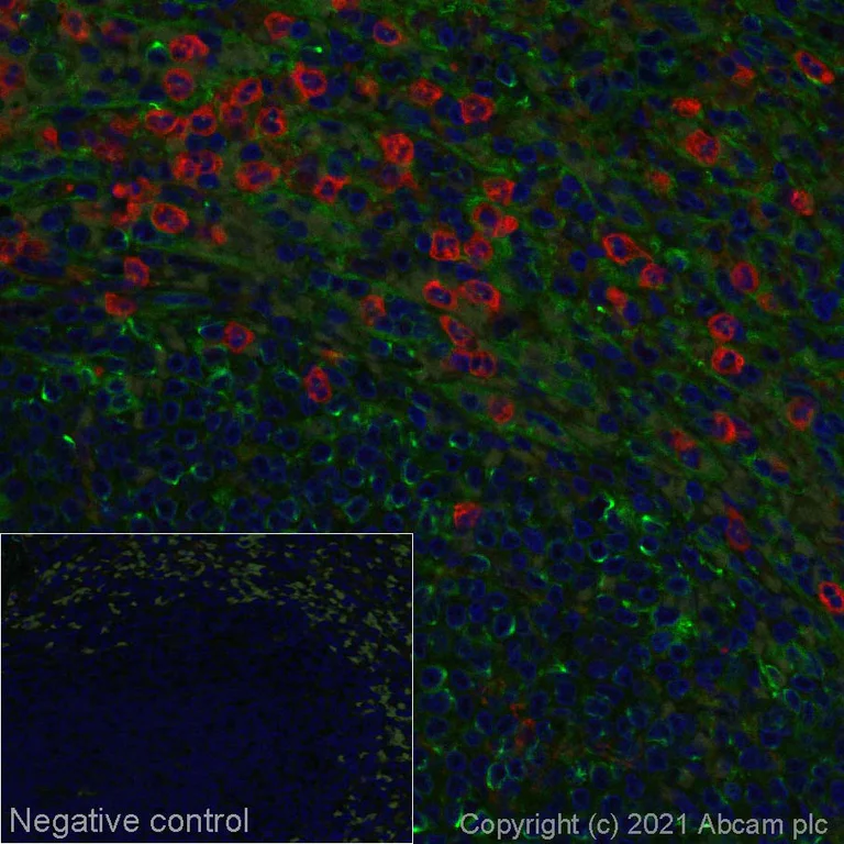 Immunohistochemistry (Formalin/PFA-fixed paraffin-embedded sections) - Alexa Fluor® 647 Anti-C5a-R antibody [EPR23278-117] (AB281320)