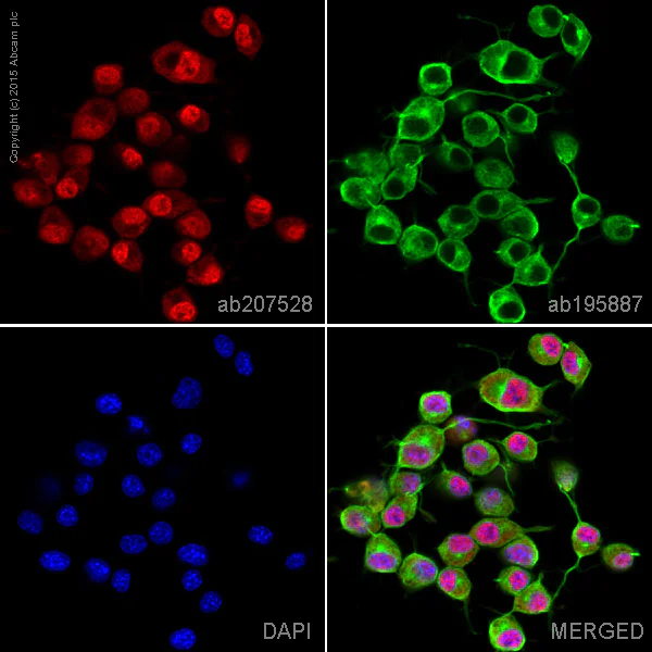 Immunocytochemistry/ Immunofluorescence - Alexa Fluor® 647 Anti-Calbindin antibody [EP3478] (AB207528)