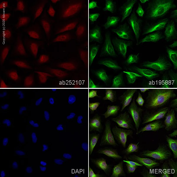 Immunocytochemistry - Alexa Fluor® 647 Anti-Calcineurin A antibody [EPR1670(2)] (AB252107)