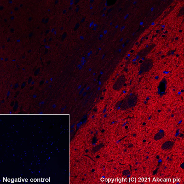 Immunohistochemistry (Formalin/PFA-fixed paraffin-embedded sections) - Alexa Fluor® 647 Anti-Calcineurin A antibody [EPR24997-22] (AB284134)