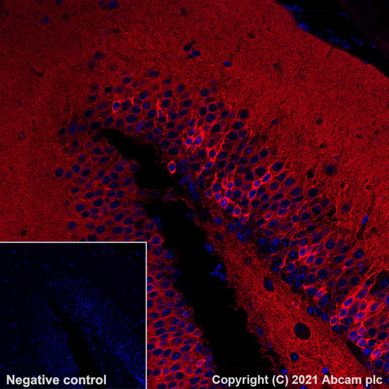 Immunohistochemistry (Formalin/PFA-fixed paraffin-embedded sections) - Alexa Fluor® 647 Anti-Calcineurin A antibody [EPR24997-22] (AB284134)
