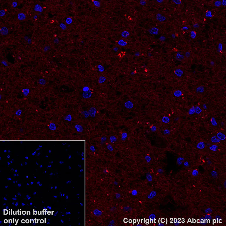 Immunohistochemistry (Formalin/PFA-fixed paraffin-embedded sections) - Alexa Fluor® 647 Anti-Calcineurin B/PPP3R1 antibody [EPR24992-18] (AB315850)