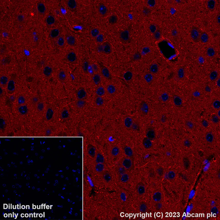 Immunohistochemistry (Formalin/PFA-fixed paraffin-embedded sections) - Alexa Fluor® 647 Anti-Calcineurin B/PPP3R1 antibody [EPR24992-18] (AB315850)