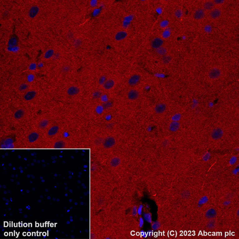 Immunohistochemistry (Formalin/PFA-fixed paraffin-embedded sections) - Alexa Fluor® 647 Anti-Calcineurin B/PPP3R1 antibody [EPR24992-18] (AB315850)