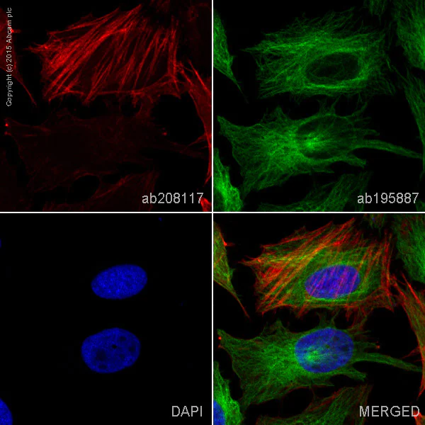 Immunocytochemistry/ Immunofluorescence - Alexa Fluor® 647 Anti-Caldesmon/CDM antibody [E89] (AB208117)
