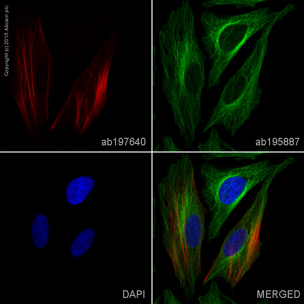 Immunocytochemistry/ Immunofluorescence - Alexa Fluor® 647 Anti-Calponin 1 antibody [EP798Y] (AB197640), expandable thumbnail