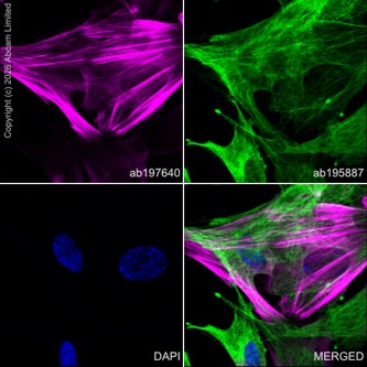 Immunocytochemistry/ Immunofluorescence - Alexa Fluor® 647 Anti-Calponin 1 antibody [EP798Y] (AB197640)