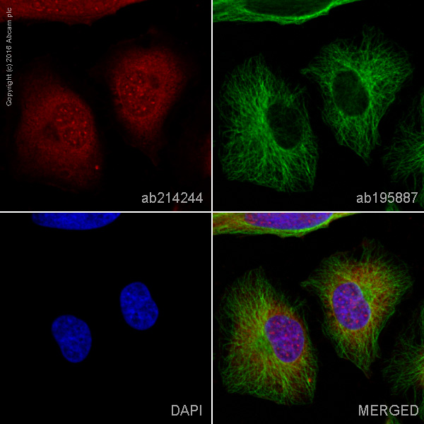 Immunocytochemistry/ Immunofluorescence - Alexa Fluor® 647 Anti-Calretinin antibody [EP1798] (AB214244)