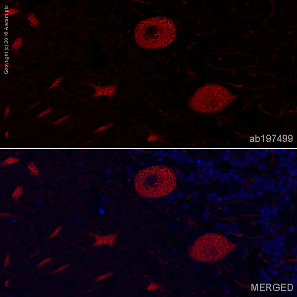 Immunohistochemistry (Formalin/PFA-fixed paraffin-embedded sections) - Alexa Fluor® 647 Anti-CaMKII alpha antibody [6G9] (AB197499)