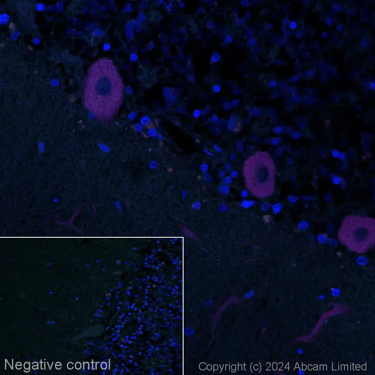 Immunohistochemistry (Formalin/PFA-fixed paraffin-embedded sections) - Alexa Fluor® 647 Anti-CaMKII alpha antibody [6G9] (AB197499)