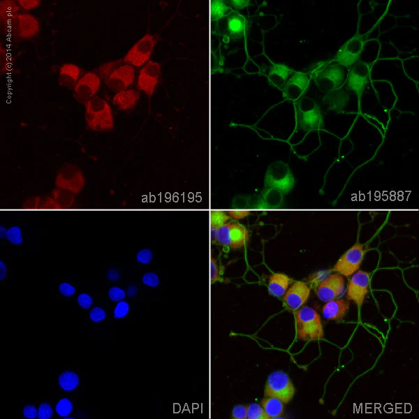 Immunocytochemistry/ Immunofluorescence - Alexa Fluor® 647 Anti-CaMKII antibody [EP1829Y] (AB196165)