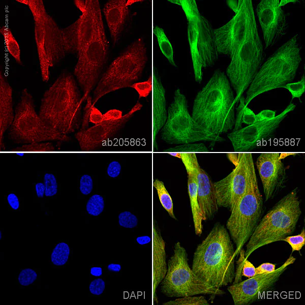 Immunocytochemistry/ Immunofluorescence - Alexa Fluor® 647 Anti-CaMKII antibody [EPR6686(2)] (AB205863)