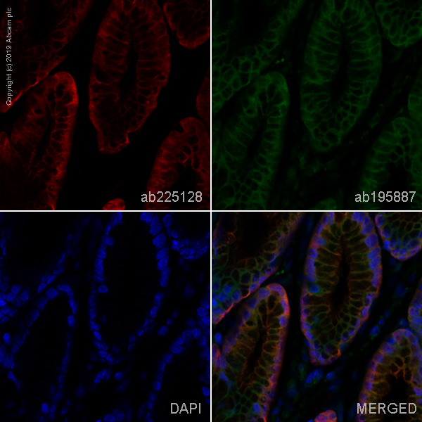 Immunohistochemistry (Formalin/PFA-fixed paraffin-embedded sections) - Alexa Fluor® 647 Anti-Carbonic anhydrase 2/CA2 antibody [EPR5195] (AB225128)