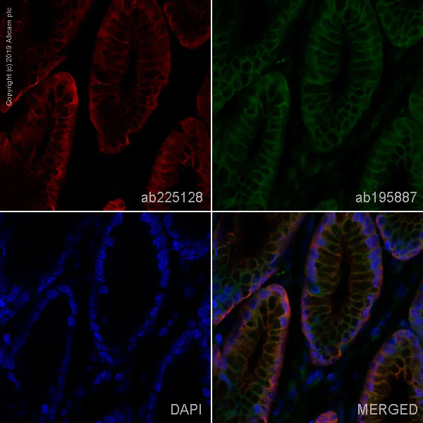 Immunohistochemistry (Formalin/PFA-fixed paraffin-embedded sections) - Alexa Fluor® 647 Anti-Carbonic anhydrase 2/CA2 antibody [EPR5195] (AB225128)