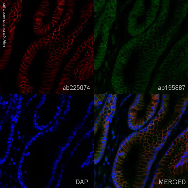 Immunohistochemistry (Formalin/PFA-fixed paraffin-embedded sections) - Alexa Fluor® 647 Anti-Carbonic Anhydrase 9/CA9 antibody [EPR4151(2)] (AB225074)