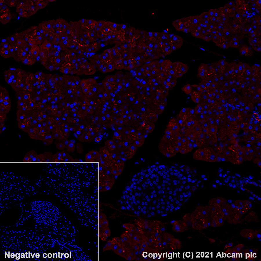 Immunohistochemistry (Formalin/PFA-fixed paraffin-embedded sections) - Alexa Fluor® 647 Anti-Carboxypeptidase A antibody [EPR24384-69] (AB282196), expandable thumbnail
