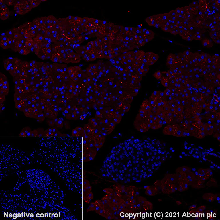 Immunohistochemistry (Formalin/PFA-fixed paraffin-embedded sections) - Alexa Fluor® 647 Anti-Carboxypeptidase A antibody [EPR24384-69] (AB282196)