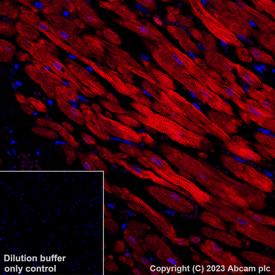 Alexa Fluor® 647 Anti-Cardiac Troponin I antibody [EPR20307