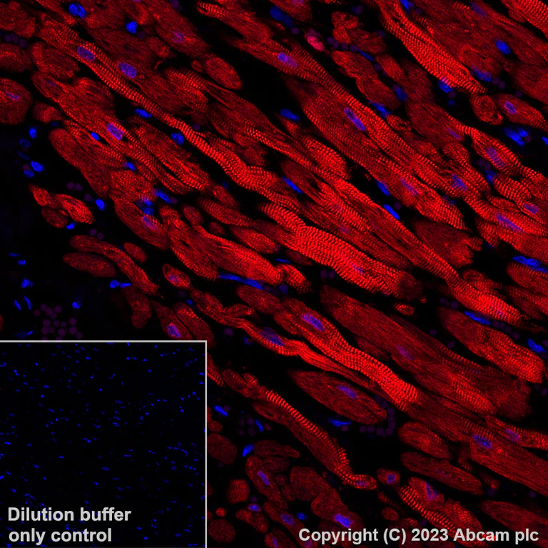 Immunohistochemistry (Formalin/PFA-fixed paraffin-embedded sections) - Alexa Fluor® 647 Anti-Cardiac Troponin I antibody [EPR20307] (AB309162)