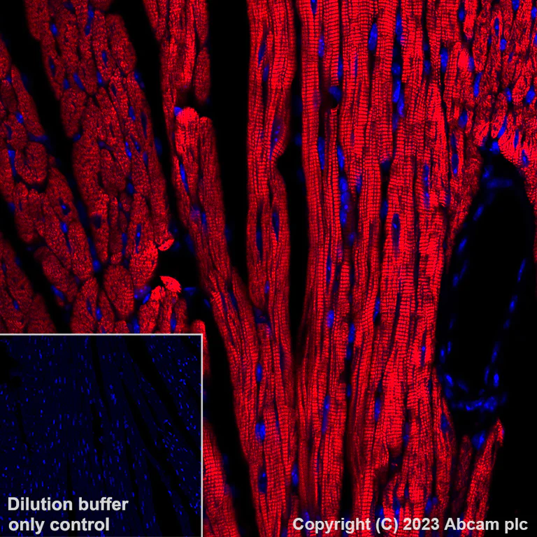 Immunohistochemistry (Formalin/PFA-fixed paraffin-embedded sections) - Alexa Fluor® 647 Anti-Cardiac Troponin I antibody [EPR20307] (AB309162)